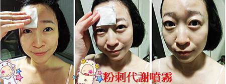 粉刺代謝噴霧 粉刺代謝噴霧