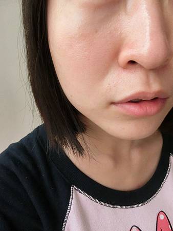 粉刺代謝噴霧 粉刺代謝噴霧