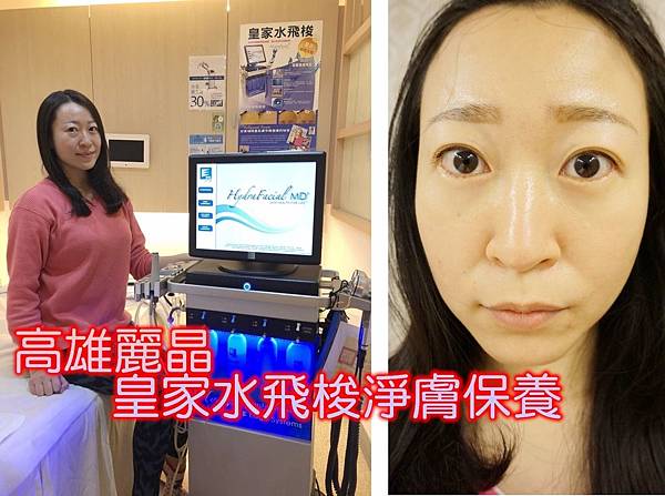 高雄微整型高雄麗晶 皇家水飛梭淨膚保養,讓我全臉像是喝飽了水