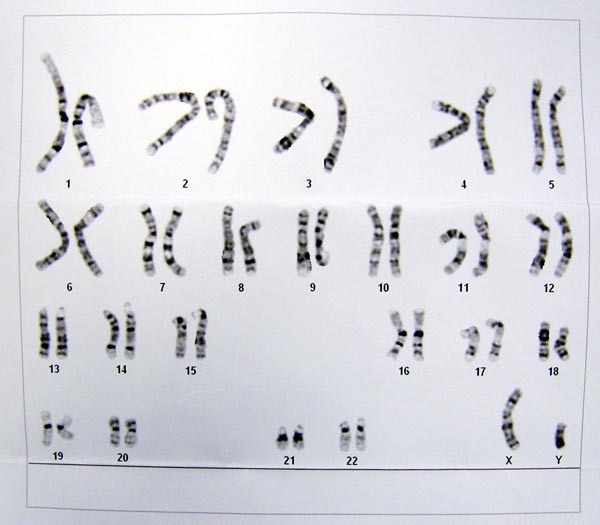 23對染色體