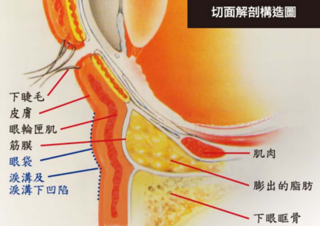 下眼袋圖