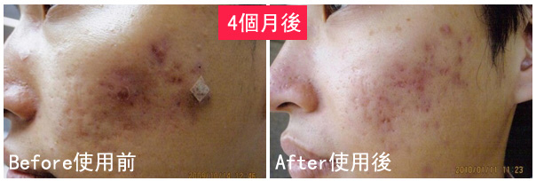 K小姐使用前後比對圖.jpg K小姐使用前後比對圖.jpg