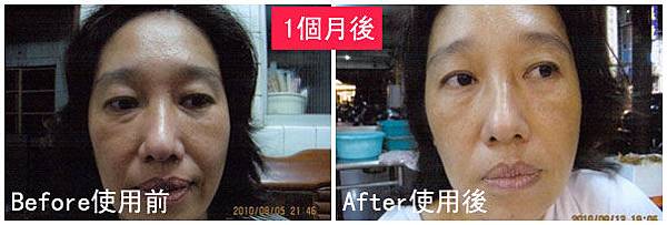 N小姐使用前後比對圖.jpg N小姐使用前後比對圖.jpg