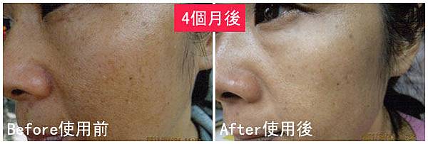 O小姐使用前後比對圖.jpg O小姐使用前後比對圖.jpg