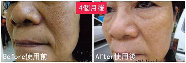 R小姐使用前後比對圖.jpg R小姐使用前後比對圖.jpg