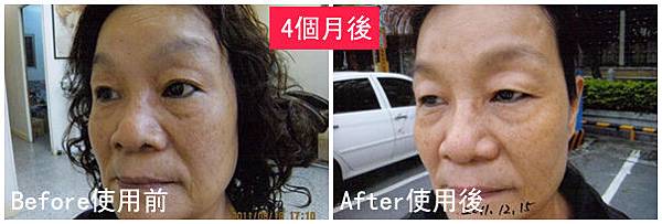 S小姐使用前後比對圖.jpg S小姐使用前後比對圖.jpg