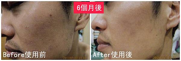 U先生使用前後比對圖.jpg U先生使用前後比對圖.jpg