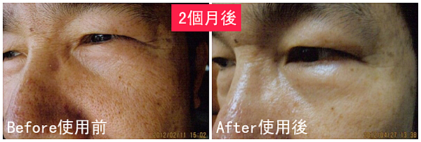 V先生使用前後比對圖.png V先生使用前後比對圖.png