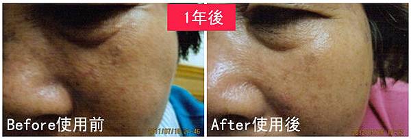 X女士使用前後比對圖.jpg X女士使用前後比對圖.jpg