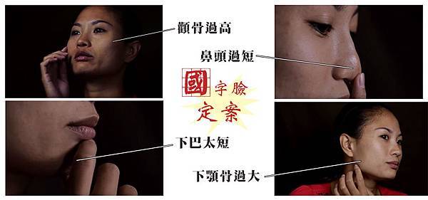 教主醫美整形外科診所郭菁松醫師削骨案例 教主醫美整形外科診所郭菁松醫師削骨案例