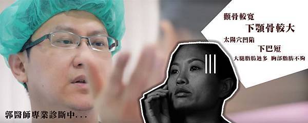 郭菁松削骨-06.jpg 郭菁松削骨-06.jpg