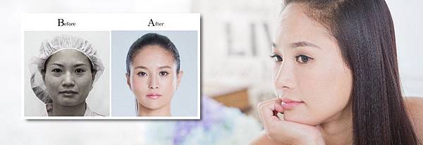 崔小咪整形日記心得分享.jpg.jpg.jpg 崔小咪整形日記心得分享.jpg.jpg.jpg