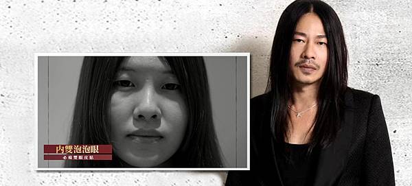 02割縫雙眼皮手術恢復期.jpg 02割縫雙眼皮手術恢復期.jpg