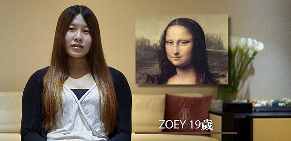 03割縫雙眼皮前後比對照片.jpg 03割縫雙眼皮前後比對照片.jpg