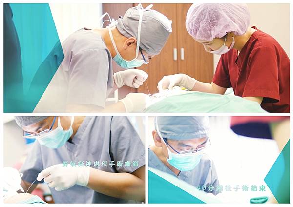 10訂書針縫雙眼皮永久.jpg 10訂書針縫雙眼皮永久.jpg