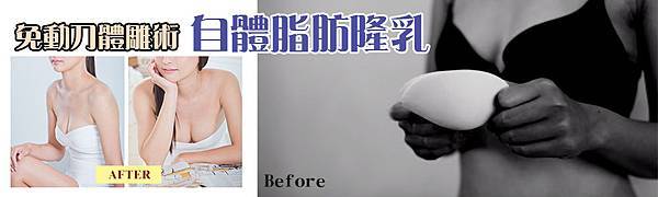 001自體脂肪隆乳豐胸手術價格價錢費用價位.jpg 001自體脂肪隆乳豐胸手術價格價錢費用價位.jpg