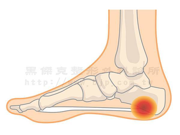 腳側面.jpg 腳側面.jpg