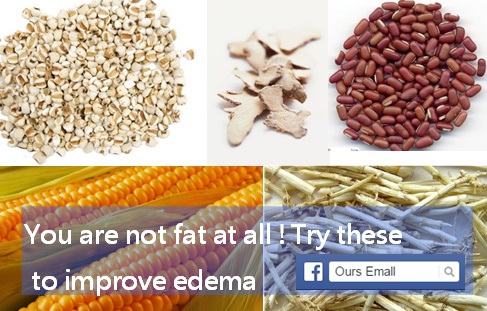 You are not fat at all !Try these  to improve edema