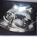 16w5d