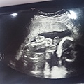 20w5d