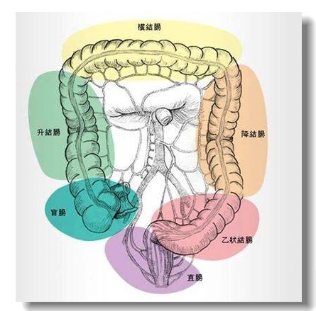 大腸癌-1