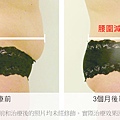 Liposonix文案2.jpg