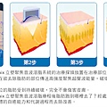 Liposonix文案5.jpg