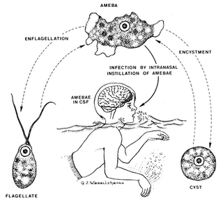 巴基斯坦出現專吃大腦寄生蟲(brain-eating
                amoeba) - 巴基斯坦專吃大腦寄生蟲