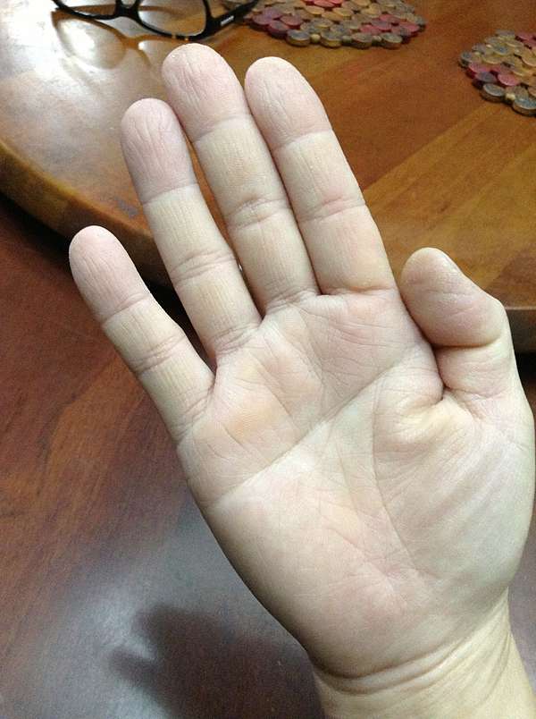 掌紋學1 女人斷掌 Boss Madam董娘玄學教室 痞客邦 掌紋學1 女人斷掌 Boss Madam董娘玄學教室 痞客邦