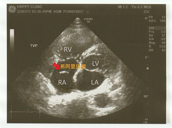 心超2(+說明).jpg