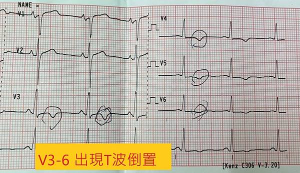 心電圖.jpg