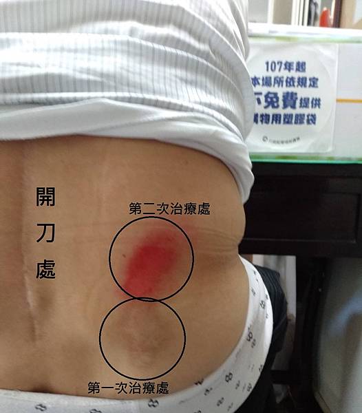 本店的傳統吊膏 本店的傳統吊膏