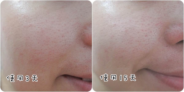 邀稿 Paula 39 S Choice寶拉珍選 1 水楊酸凝膠輕鬆改善毛孔粗大困擾 衝吧 我的小宇宙 痞客邦