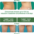 tummytuck-before-after (1).jpg