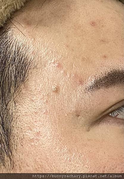 保養｜這半年來的膚況改變＿中永和皮膚科專科診所【皮醫美】