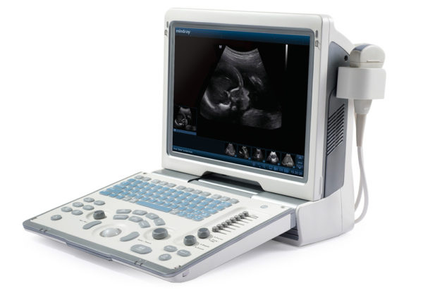 DP-50-ultrasound-rgb-1-600x436.jpg