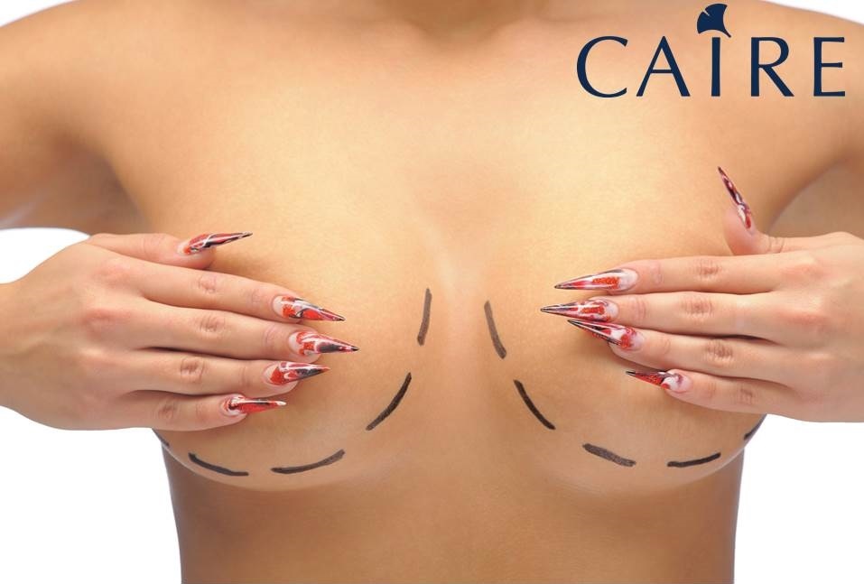 水袋隆乳 水袋隆乳