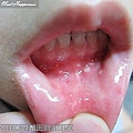 01-20110625酷比腸病毒08.jpg