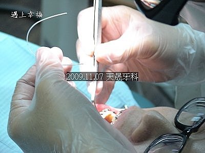 06 2009.11.07牙齒矯正.jpg