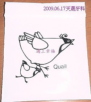 0617-2009牙齒矯正6橡皮筋.jpg