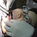 1牙齒矯正天晟牙科5-27.jpg