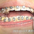 08 2009.10.19天晟牙科 牙齒矯正.j