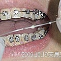 07 2009.10.19天晟牙科 牙齒矯正.j