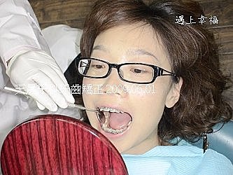 0601-2009牙齒矯正1.jpg