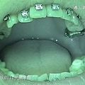 20090711天晟牙齒矯正15.jpg