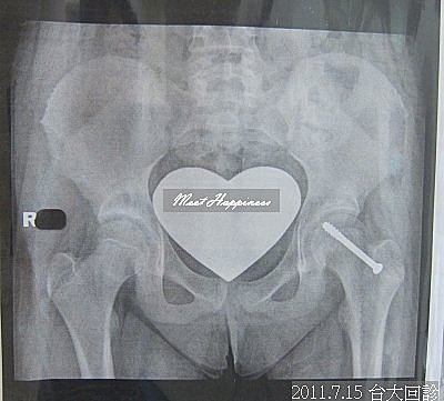 01-20110715 Q比台大回診06.jpg