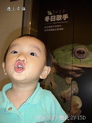 03 2009年Q比DDH回診.jpg