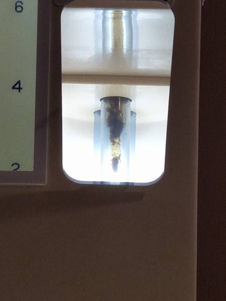 桃園水天使診所水療,水療,大腸水療,便秘,腹脹氣,桃園水天使診所