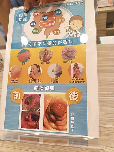 桃園水天使診所水療,水療,大腸水療,便秘,腹脹氣,桃園水天使診所