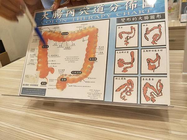 桃園水天使診所水療,水療,大腸水療,便秘,腹脹氣,桃園水天使診所
